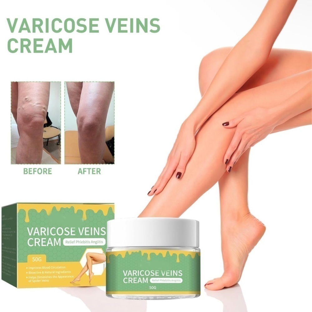 Varicose Veins Cream - Green Nourishing Leg Gel (50g) Lot Of 3 NEW